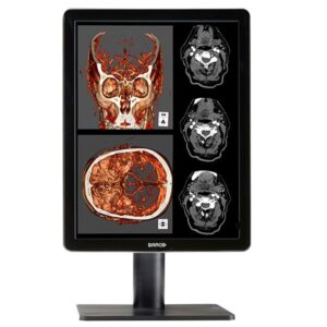 Медицинский монитор Barco Nio Color 2MP LED MDNC-2221