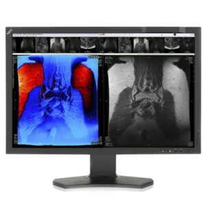 Медицинский монитор NEC MD242C2